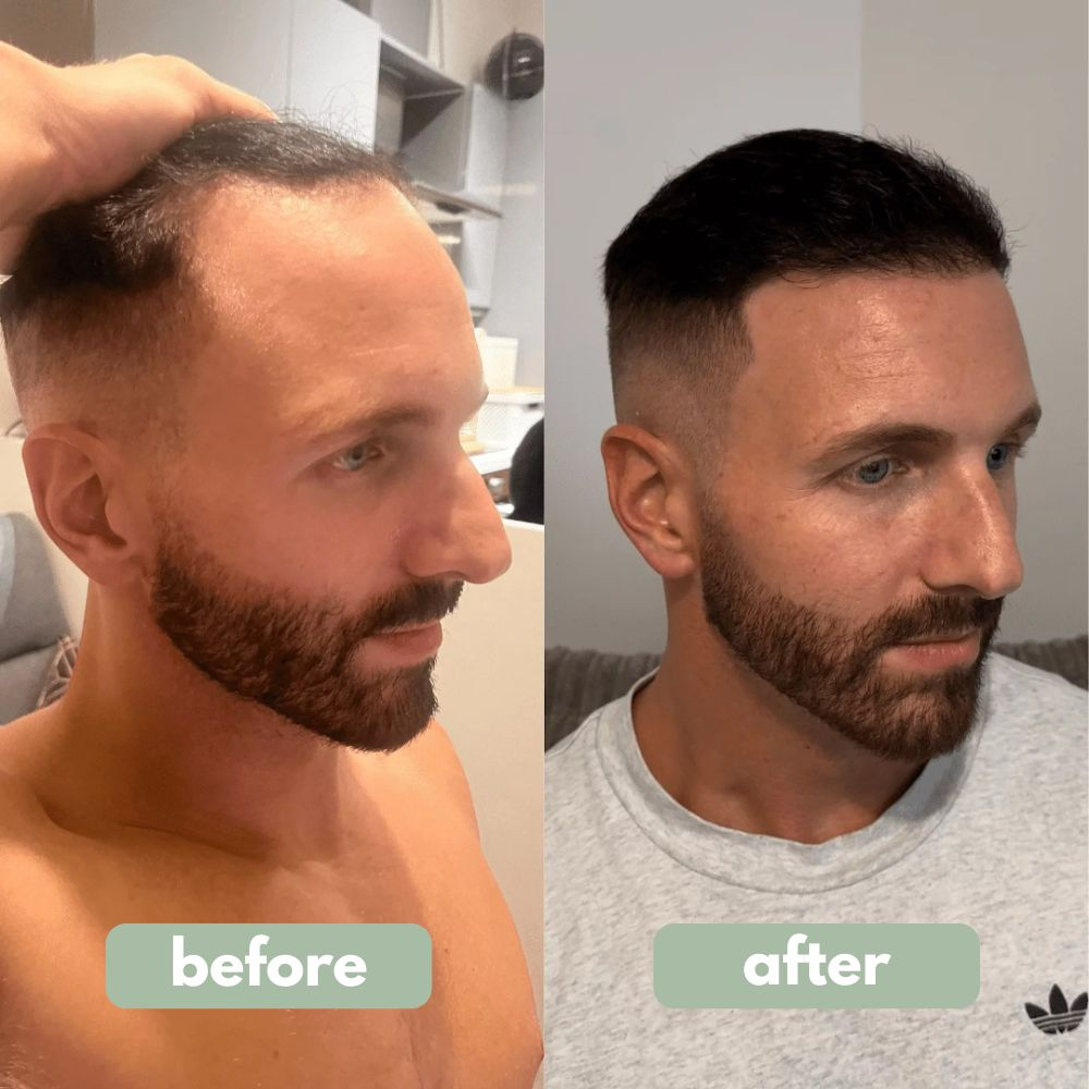 Hair Growth Serum Roll-On